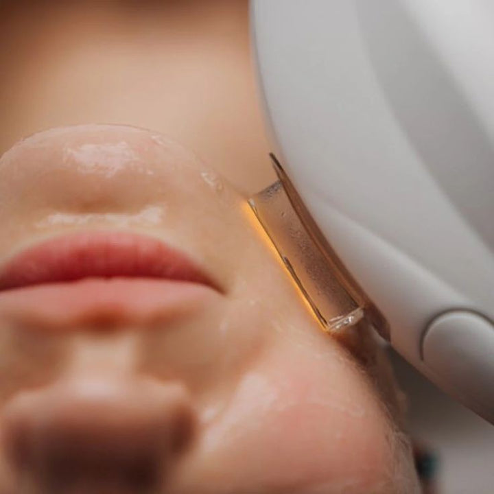 IPL TREATMENT/ $25 DEPÓSITO